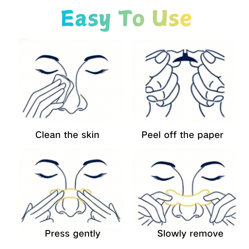 Aeru Nasal Airflow Strips